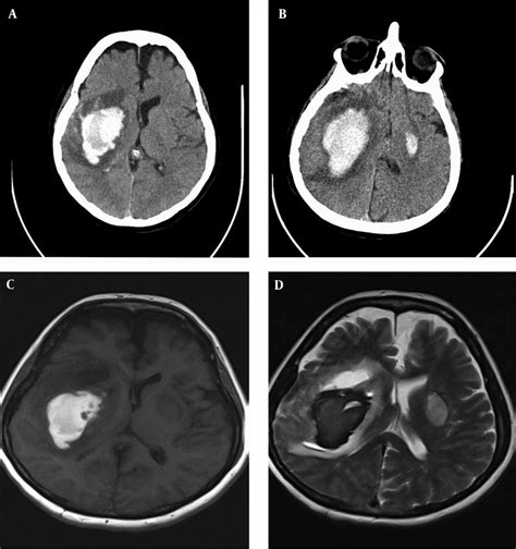 Massive ich outbreak .